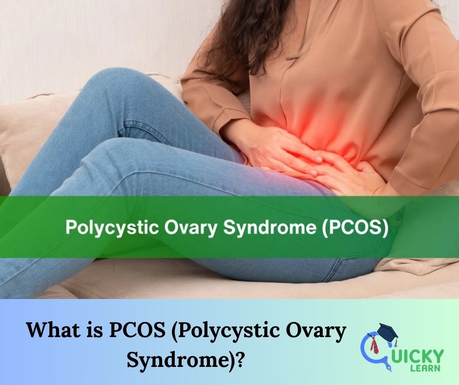 You are currently viewing What is PCOS (Polycystic Ovary Syndrome)?