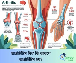 Read more about the article আর্থ্রাইটিস কি? কি কারণে আর্থ্রাইটিস হয়?