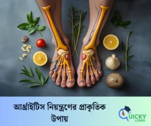 Read more about the article আর্থ্রাইটিস নিয়ন্ত্রণের প্রাকৃতিক উপায়