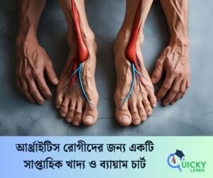Read more about the article আর্থ্রাইটিস রোগীদের জন্য একটি সাপ্তাহিক খাদ্য ও ব্যায়াম চার্ট