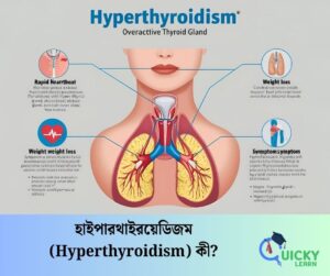 Read more about the article হাইপারথাইরয়েডিজম (Hyperthyroidism) কী?
