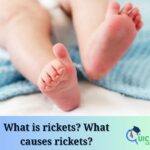 What is rickets? What causes rickets?