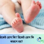 রিকেট রোগ কি? রিকেট রোগ কি কারণে হয়?