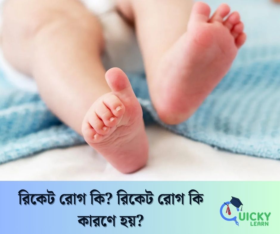 You are currently viewing রিকেট রোগ কি? রিকেট রোগ কি কারণে হয়?